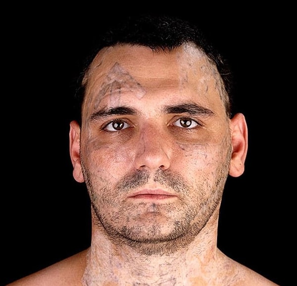 9. И они были очень болезненными — Уиднер кричал на операционном столе.