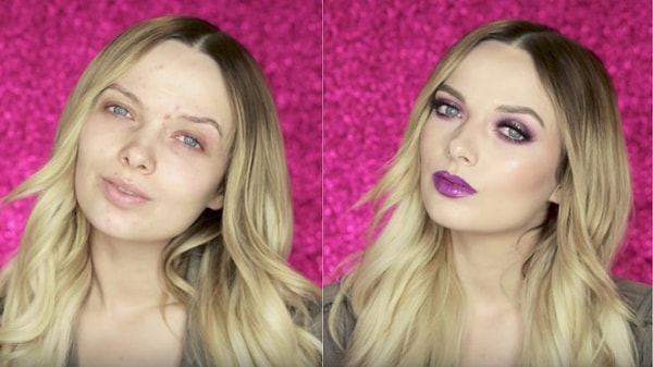 4. Эм Форд - чудесное преображение проблемной кожи