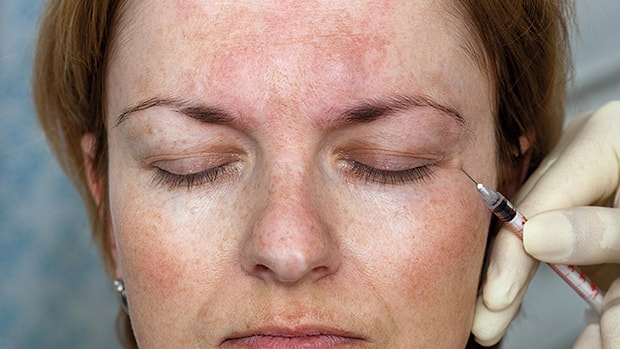 Her Gordugumde Canimi Sikan Goz Alti Morluklarimdan Kurtulmak Icin Yaptirdigim Isik Dolgusu Deneyimi Her Gordugumde Canimi Sikan Goz Alti Morluklarimdan Kurtulmak Icin Yaptirdigim Isik Dolgusu Deneyimi