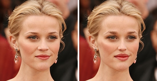 Вот как выглядели бы знаменитости, если бы сделали популярные пластические операции