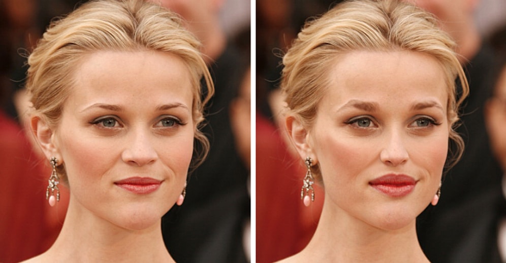 Вот как выглядели бы знаменитости, если бы сделали популярные пластические операции