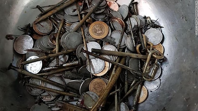 24 Kasım tarihinde Khan ameliyata alındı ve bu yabancı maddelerin hepsi çıkarıldı.