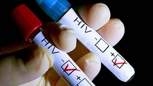 Dünyada 37 milyon kişi HIV virüsü ile yaşıyor.