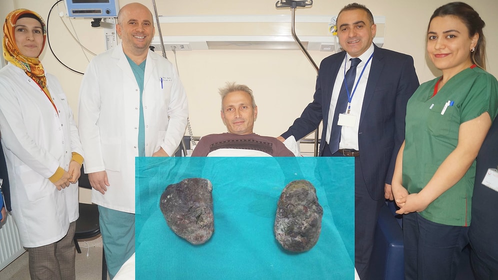 Son Hurmayı Yemeyecekti: Trabzon'da Ameliyata Giren Hastanın Midesinden 400 Gram Taş Çıktı