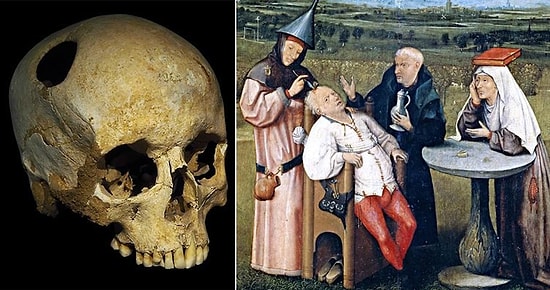 Фекалии крокодилов и пуки в бутылке: 10 сумасшедших методов лечения в истории человечества