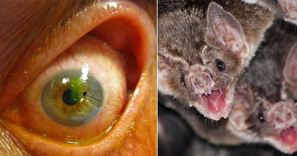 4. Кровь летучих мышей и раскаленное стекло для лечения глаз