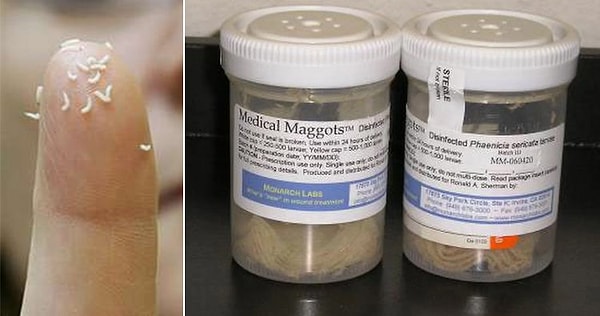 6. Личинки насекомых для очистки ран