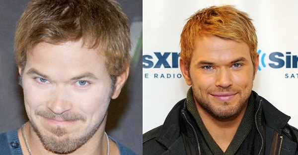 5. Исполнитель роли Эмметта Каллена, актёр Келлан Латс, явно переборщил с вампиризмом в реальной жизни 👎