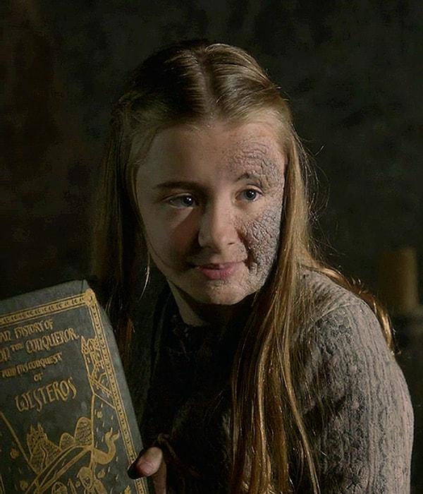 Biz onu Game of Thrones'da Stannis'in kızı Shireen Baratheon'un kızı olarak tanıdık...