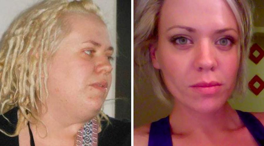 Резко изменилось лицо. Лицо до и после похудения. Похудение лица до и после фото. Лица людей до и после похудения. Кожа на лице после похудения.