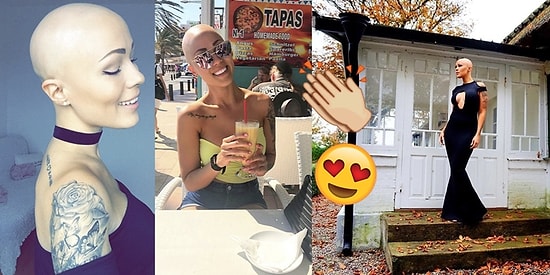 Saçlarının Dökülmesine Sebep Olan Hastalıktan Kaçmak Yerine Onun Üzerine Gidince Harikalar Yaratan Kadın!