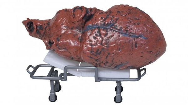 1. Ваше сердце может отказаться умирать