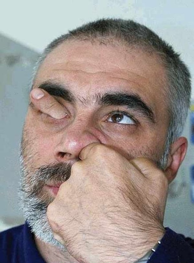1. Burnunu karıştırır mısın?