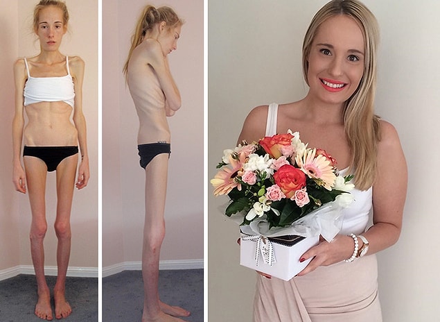 26. Bir zamanlar 2 günlük ömrü kaldığını öğrenen Gemma Walker: