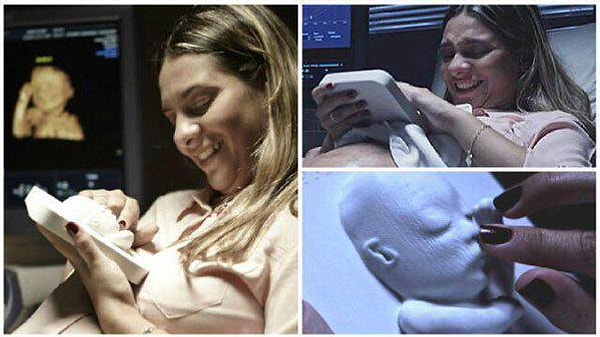 8. С помощью 3D-ультразвукового принтера незрячая мама может потрогать своего будущего малыша