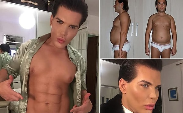 12. Он мечтал стать Кеном, а теперь его тело разваливается