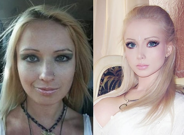 10. Она клянется, что не делала других пластических операций, кроме как увеличение груди