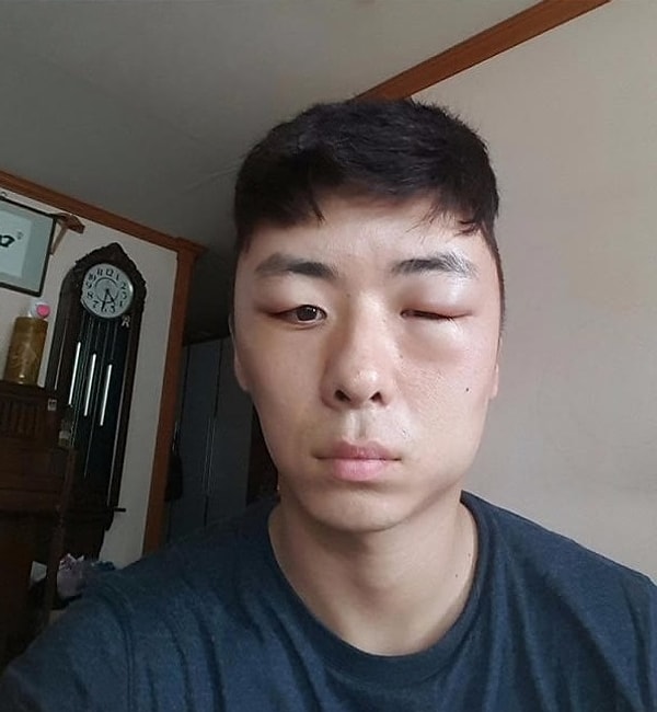 10. Не могу открыть глаза.