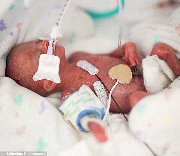 Bu dünyalar güzeli bebek Eliora Schneider 21 hafta 6 günlükken dünyaya geldi.