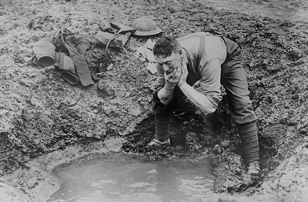 4. Как называлась особая форма отморожения нижних конечностей, которая получила широкое распространение среди солдат во время Первой мировой войны?