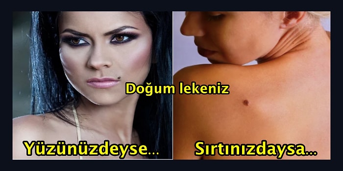 İnanılması Güç Ama Gerçek! Kişiliğinizin Sırrı Doğum Lekelerinizde Olabilir!