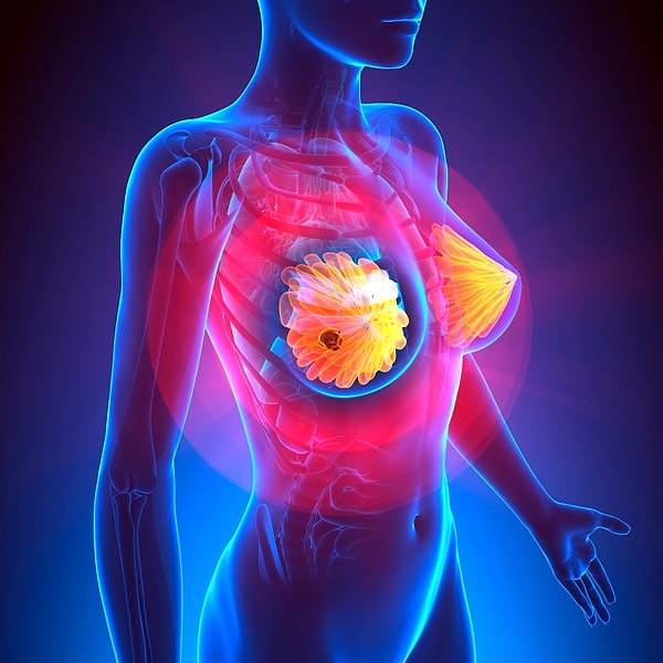 Когда предложение было сделано, на пару обрушились еще более ужасные новости: «Рак находится на 4-ой стадии, поспешите с росписью!»