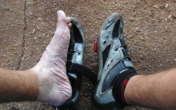 7. Вот что случается, когда лазаешь по горам 6 часов в мокрой обуви и носках