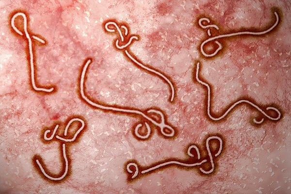 2. Ebola Virüsü