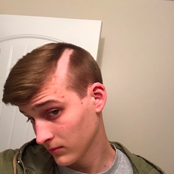 1. Выбритый висок или всё-таки проплешина - вот в чём вопрос 🤔