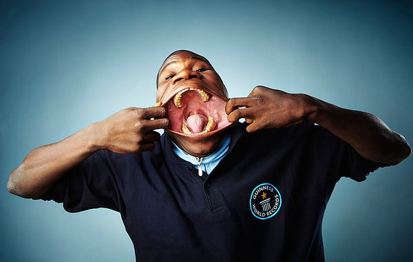 11. Жоаким Франциско