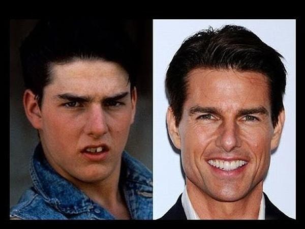 10. Mesela şu soldaki oğlan çocuğunu ıslak sopayla döversin; ama işte sağdaki Tom Cruise!