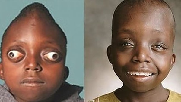 6. Петеро Бьякатонда