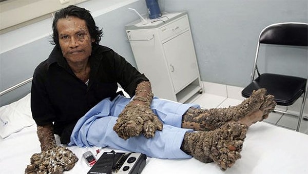 9. Деде Косвара