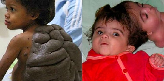 16 фото людей с ужасающими уродствами тела, которые повергнут вас в шок