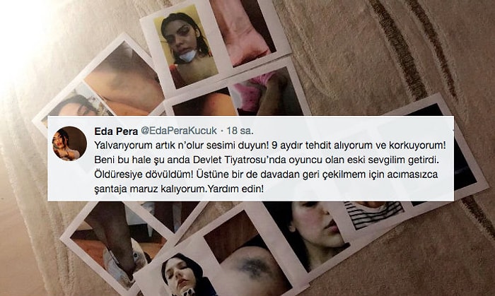 Şiddete Uğradığını Söyleyen Eda Pera Küçük, Twitter'dan Yardım İstedi: 'Ne Olur Artık Sesimi Duyun'