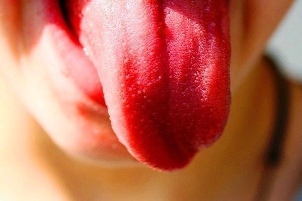 17. Parlak ve kırmızı dil, vücudunuzdaki demir veya B12 eksikliğinin işareti olabilir.