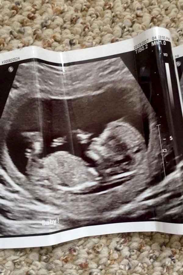 5. "Я много лет занималась различными боевыми искусствами. Сейчас я занимаюсь йогой и кардио".