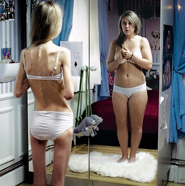 Вам постоянно кажется, что вы толстая