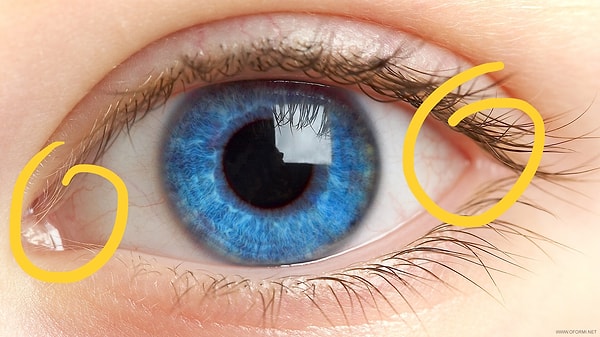 3. Сможете ли вы угадать название уголка глаза? 👀