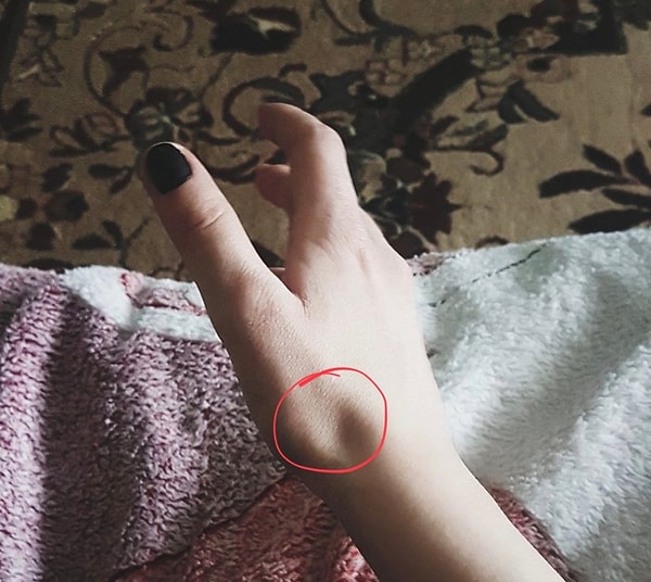 8. Какое особое название носит анатомическое углубление у основания большого пальца? 😐