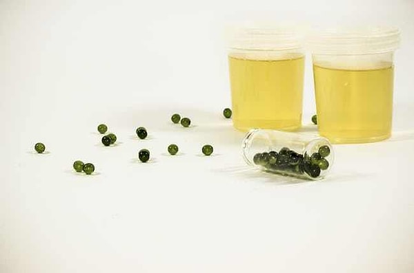 3. Уринотерапия - наше все