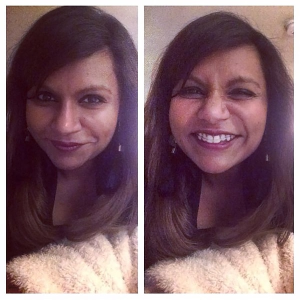 1. Минди Калинг показала фанатам свои брекеты