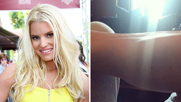 11. Да-да, волосы на ногах у знаменитостей тоже имеются, и именно это не побоялась показать миллионам подписчиком Джессика Симпсон