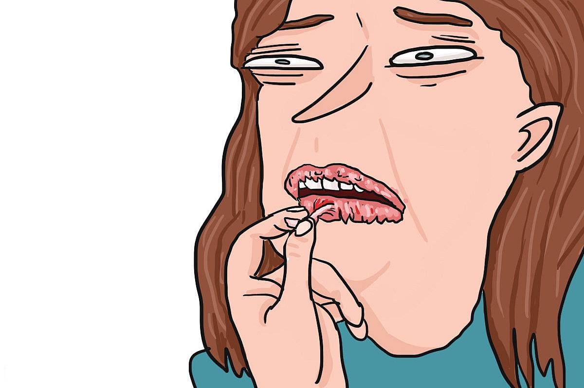 1. Отдирать сухую кожу с губ, будучи уверенной, что так они будут выглядеть намного лучше 😄