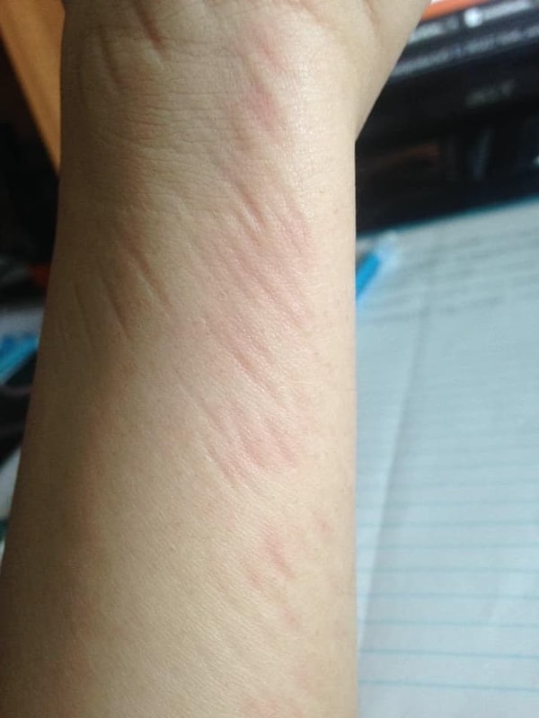 1. Вам причиняют боль даже обычные вещи...