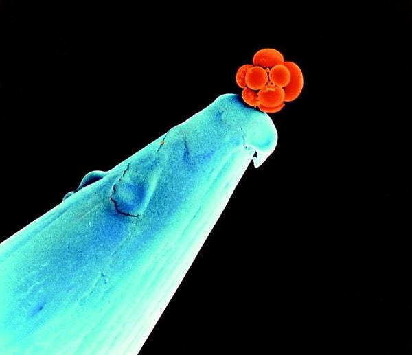10. Bir iğnenin ucundaki minik insan embriyosu.