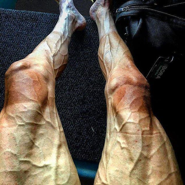 25. Tour de France'e katılan bisikletçinin tur sonrası bacakları: