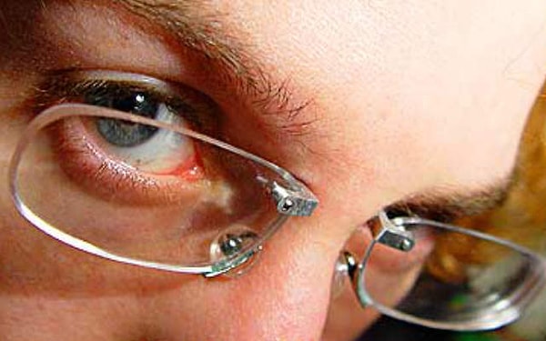 7. А эти следы от очков на носу...