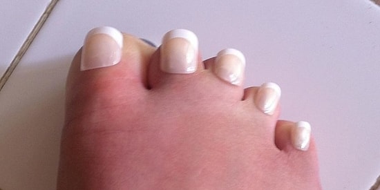 15 отвратительных фото из недр интернета, досмотреть которые сможет лишь человек с железной психикой