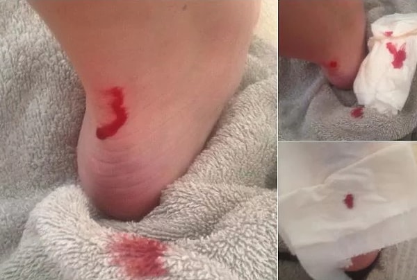 3. Зачем вы подвергаете себя пытке, отправляясь в дальнюю прогулку на высоких каблуках?